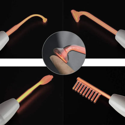 Dile adiós a la caída del cabello y al acné con la Terapia de Alta Frecuencia