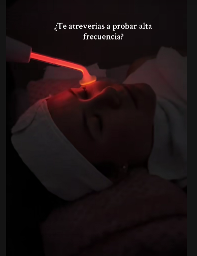 Dile adiós a la caída del cabello y al acné con la Terapia de Alta Frecuencia